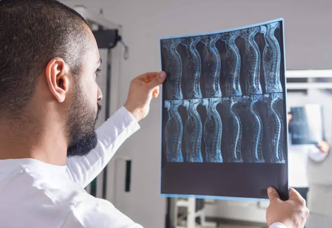 AI Revolutionizes Spinal Health Diagnostics with Automated X-ray Analysis